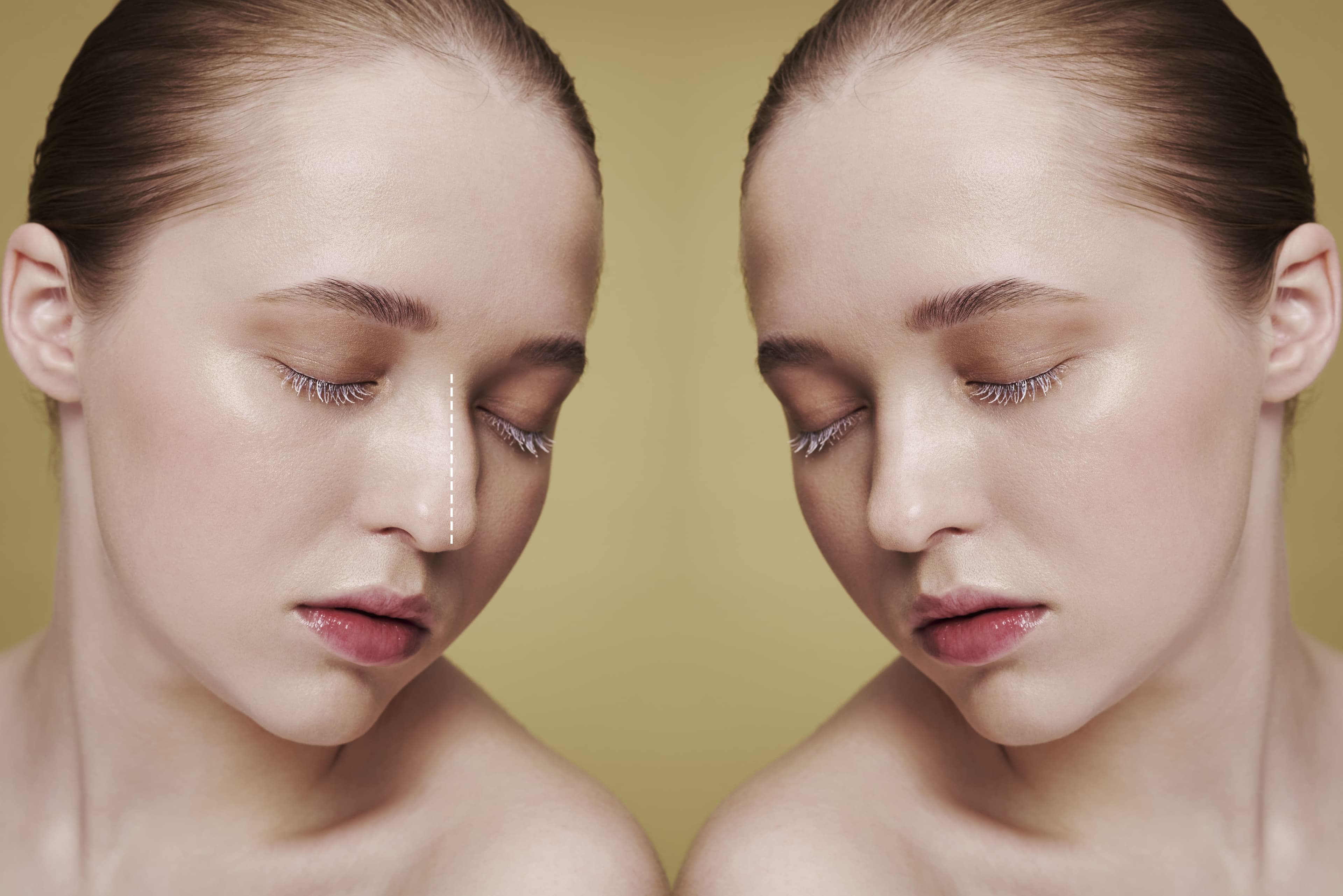 Treatment before and after