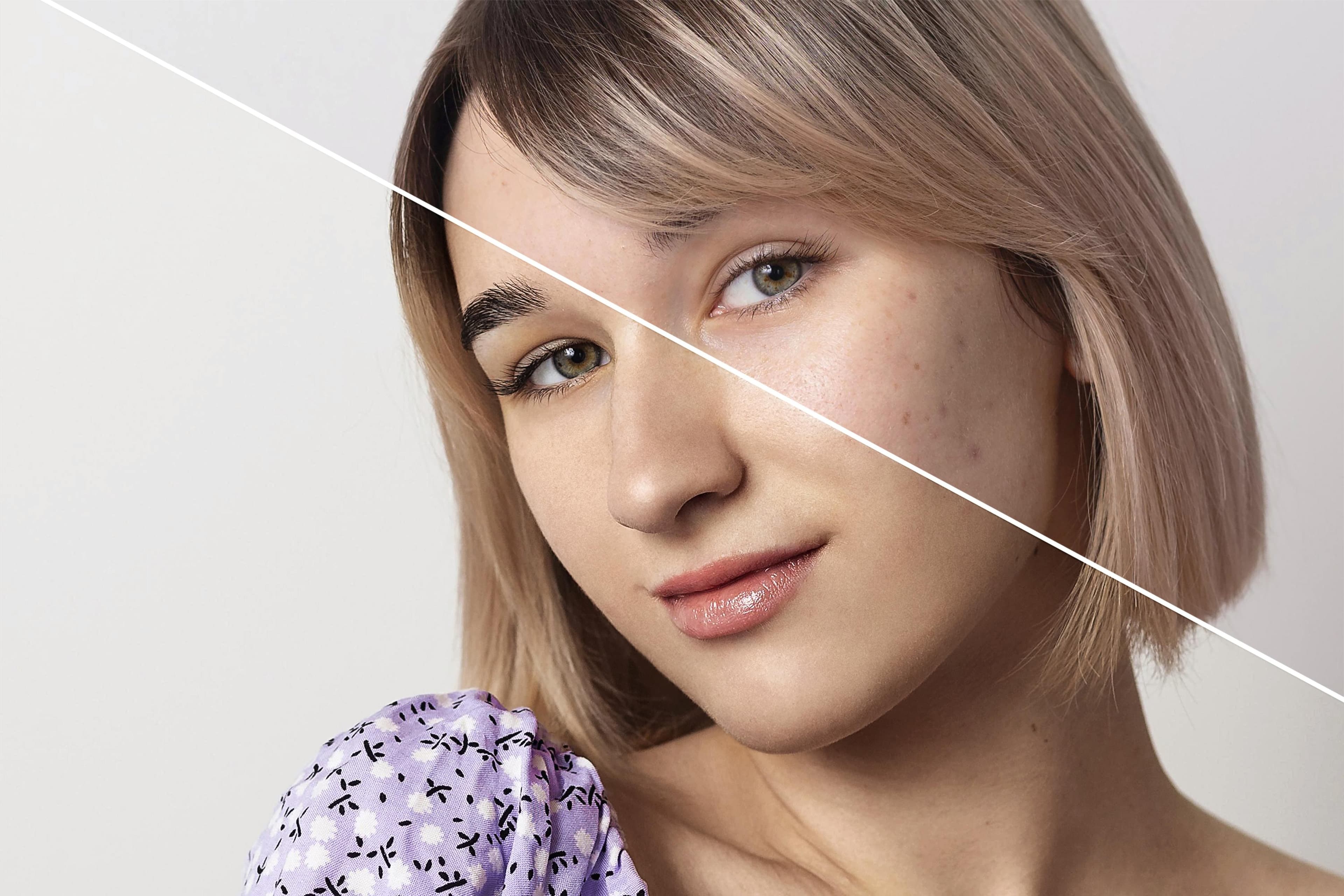 Treatment before and after