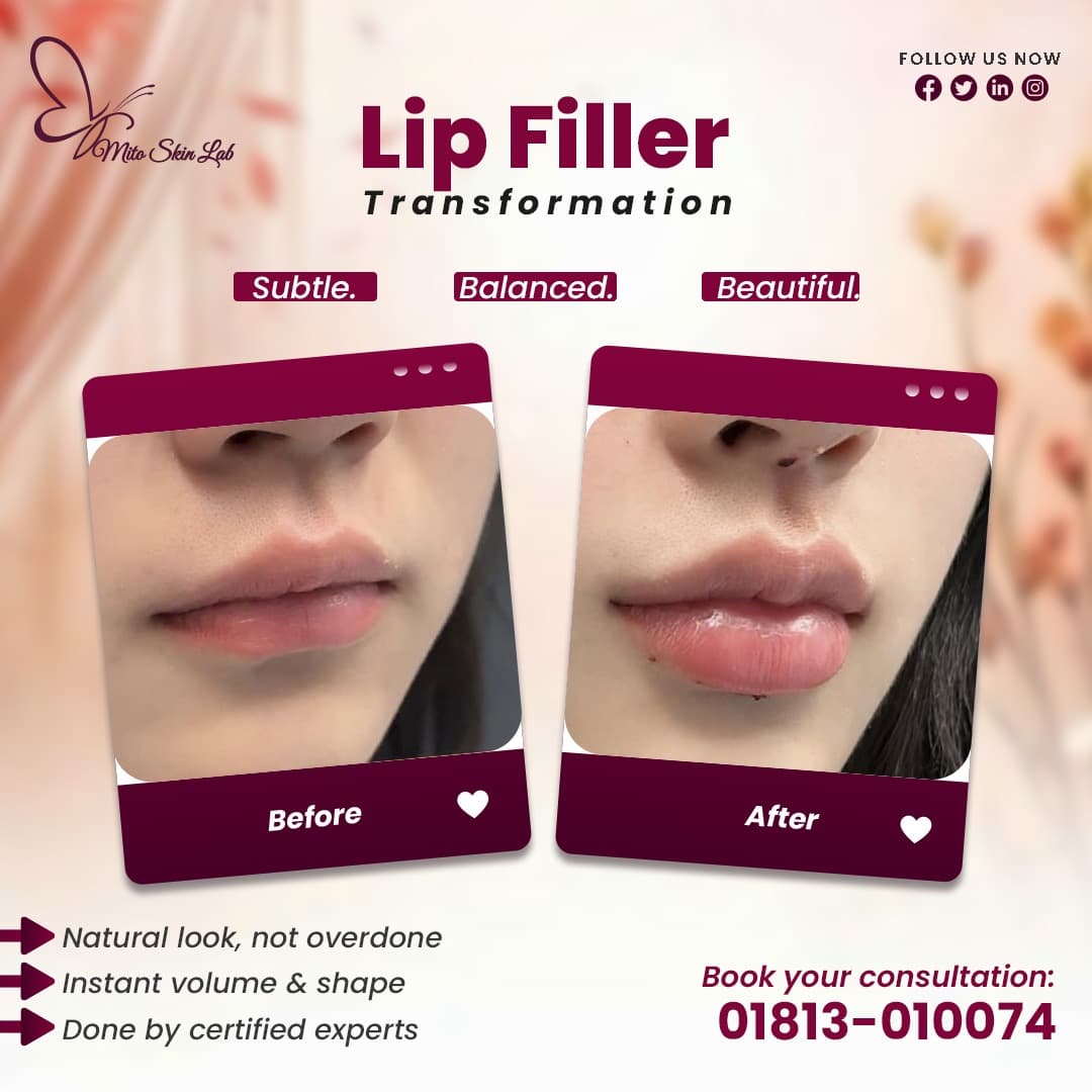 Treatment before and after