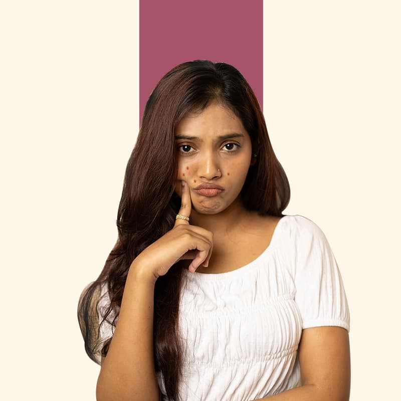 Acne & Problem Skin Treatments