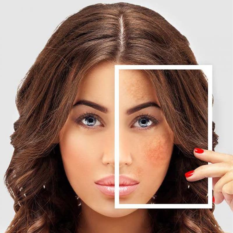 Pigmentation & Glow Treatments