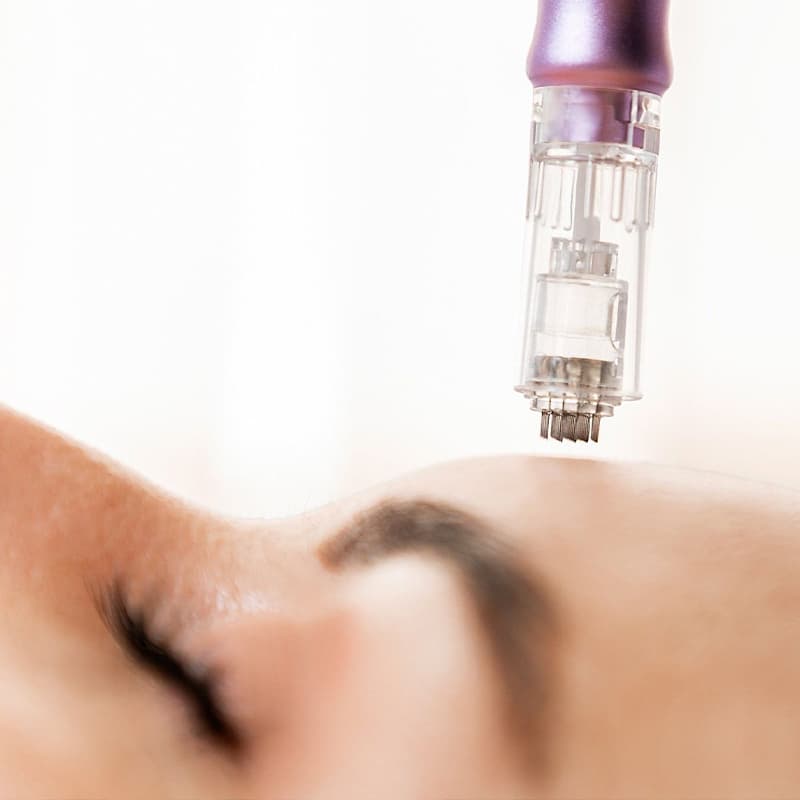 Skin Rejuvenation
